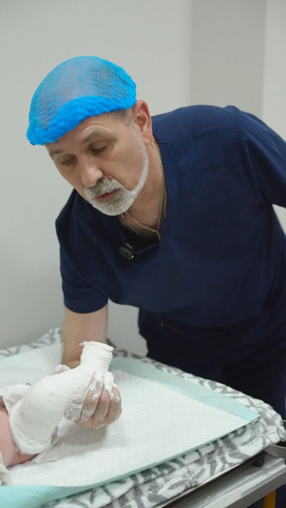 Етапне гіпсування дитини при клишоногості клініка Neurospine на Подолі