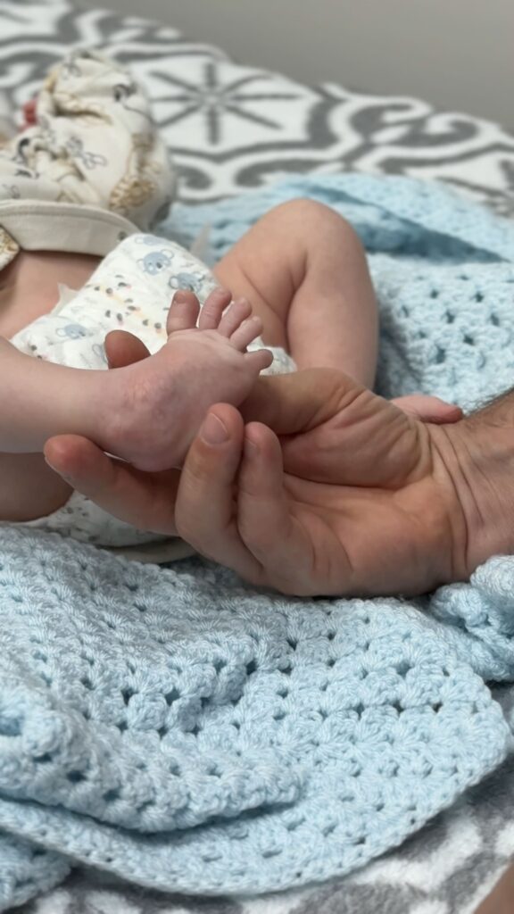 Лікування вродженої клишоногості у дітей метод Понсеті ортопед Пилипчук Київ